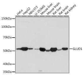 Western Blot - Anti-GLUD1 Antibody (A15814) - Antibodies.com