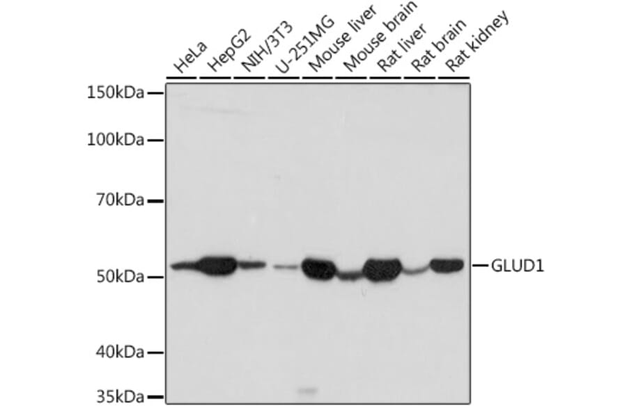 Western Blot - Anti-GLUD1 Antibody (A15814) - Antibodies.com