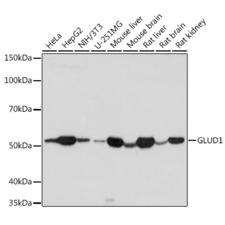 Western Blot - Anti-GLUD1 Antibody (A15814) - Antibodies.com