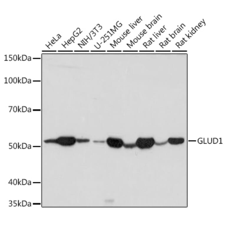 Western Blot - Anti-GLUD1 Antibody (A15814) - Antibodies.com