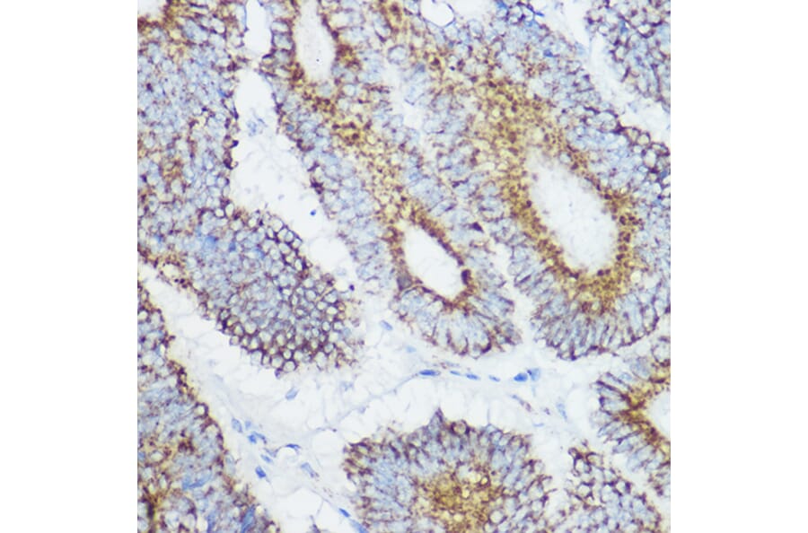 Immunohistochemistry - Anti-GLUD1 Antibody (A15814) - Antibodies.com