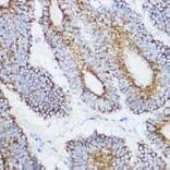 Immunohistochemistry - Anti-GLUD1 Antibody (A15814) - Antibodies.com