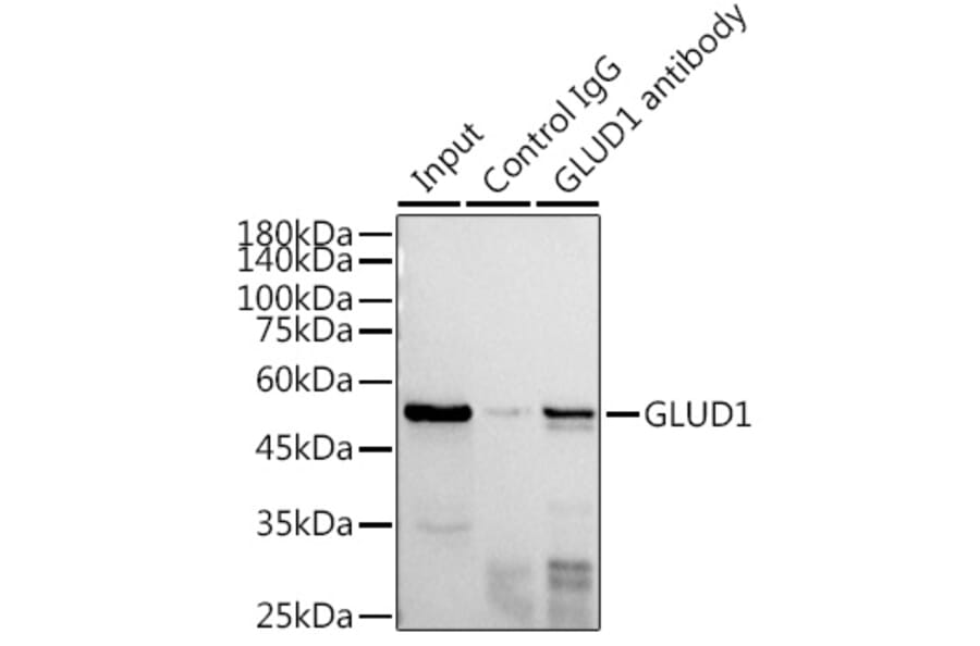 Western Blot - Anti-GLUD1 Antibody (A15814) - Antibodies.com