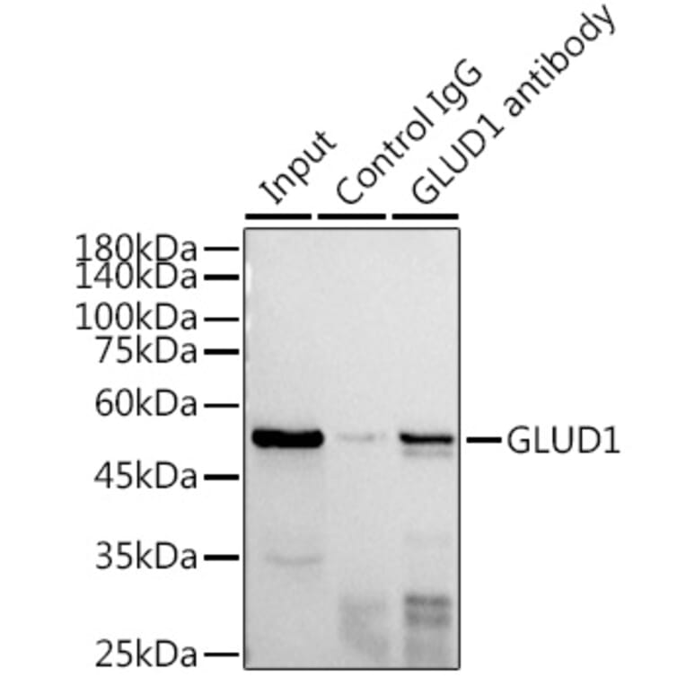 Western Blot - Anti-GLUD1 Antibody (A15814) - Antibodies.com