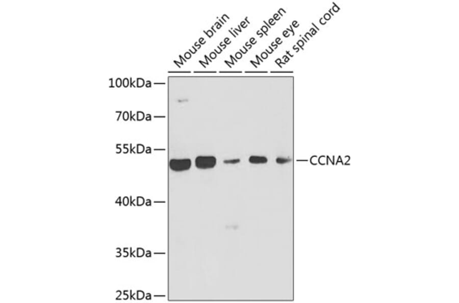 Western Blot - Anti-CCNA2 Antibody (A7632) - Antibodies.com