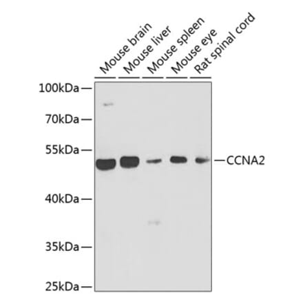 Western Blot - Anti-CCNA2 Antibody (A7632) - Antibodies.com