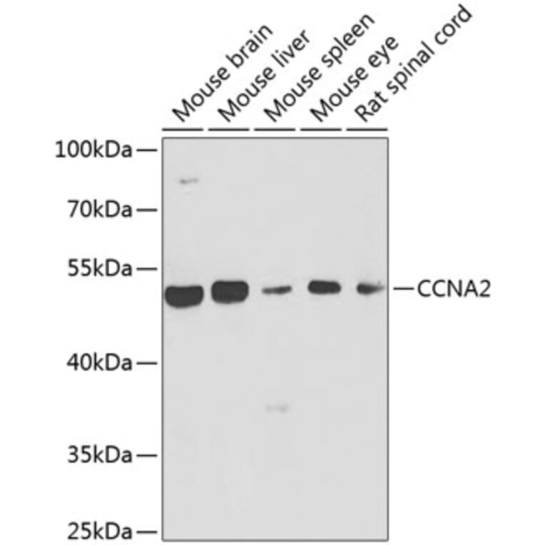 Western Blot - Anti-CCNA2 Antibody (A7632) - Antibodies.com