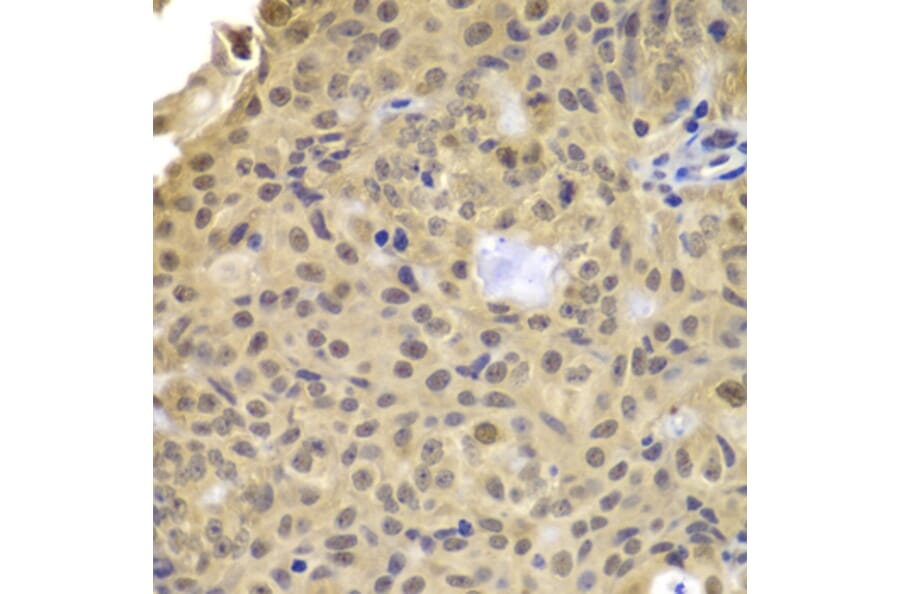 Immunohistochemistry - Anti-CCNA2 Antibody (A7632) - Antibodies.com