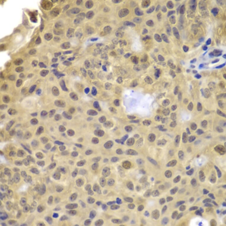 Immunohistochemistry - Anti-CCNA2 Antibody (A7632) - Antibodies.com