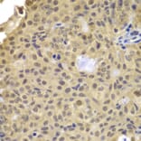 Immunohistochemistry - Anti-CCNA2 Antibody (A7632) - Antibodies.com
