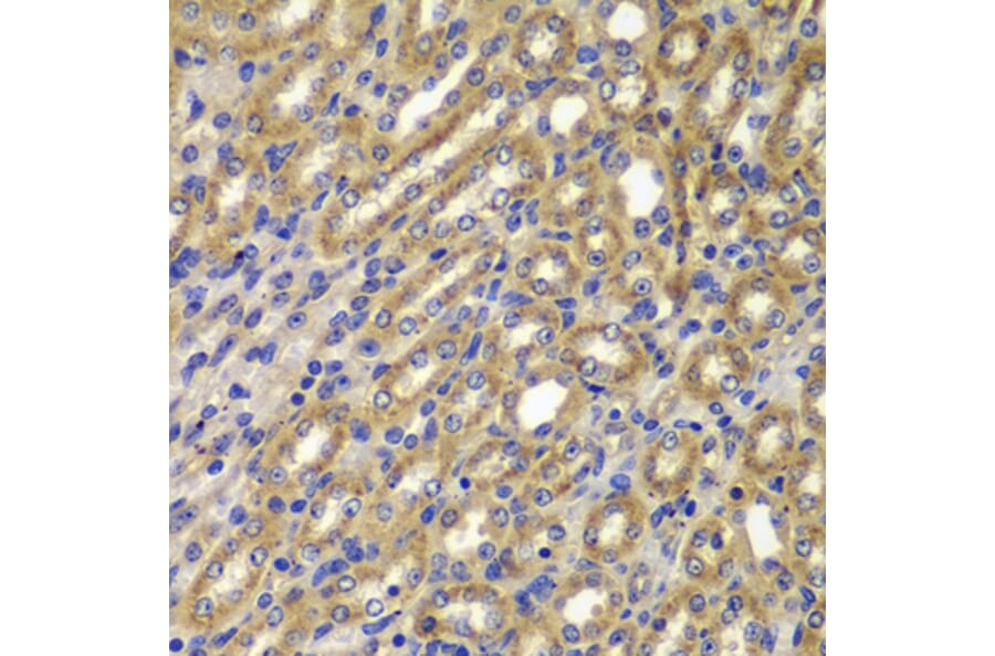 Immunohistochemistry - Anti-CCNA2 Antibody (A7632) - Antibodies.com