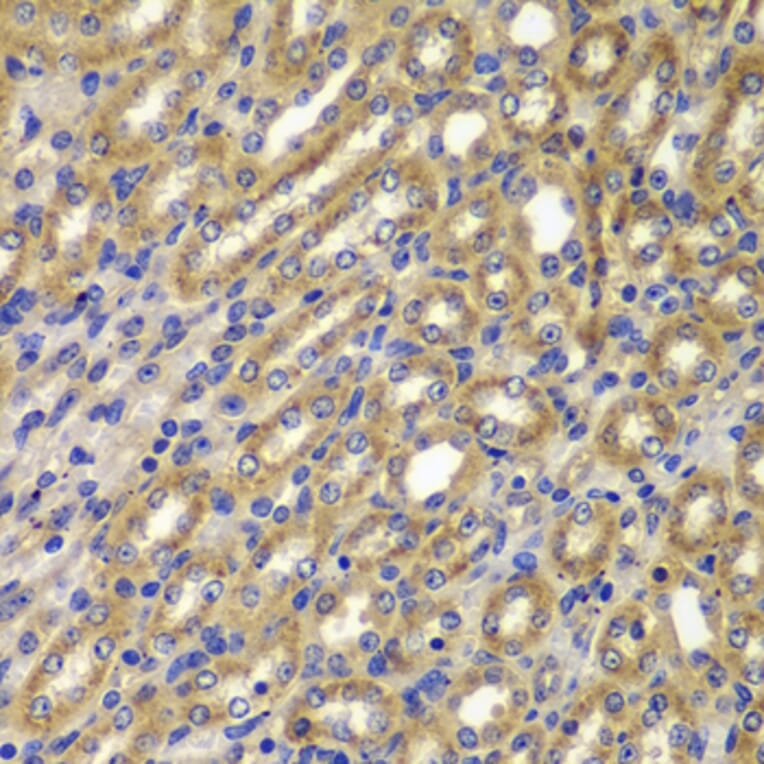 Immunohistochemistry - Anti-CCNA2 Antibody (A7632) - Antibodies.com