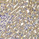 Immunohistochemistry - Anti-CCNA2 Antibody (A7632) - Antibodies.com