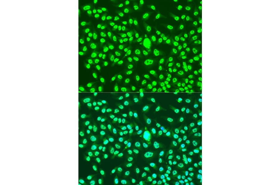 Immunofluorescence - Anti-CCNA2 Antibody (A15815) - Antibodies.com