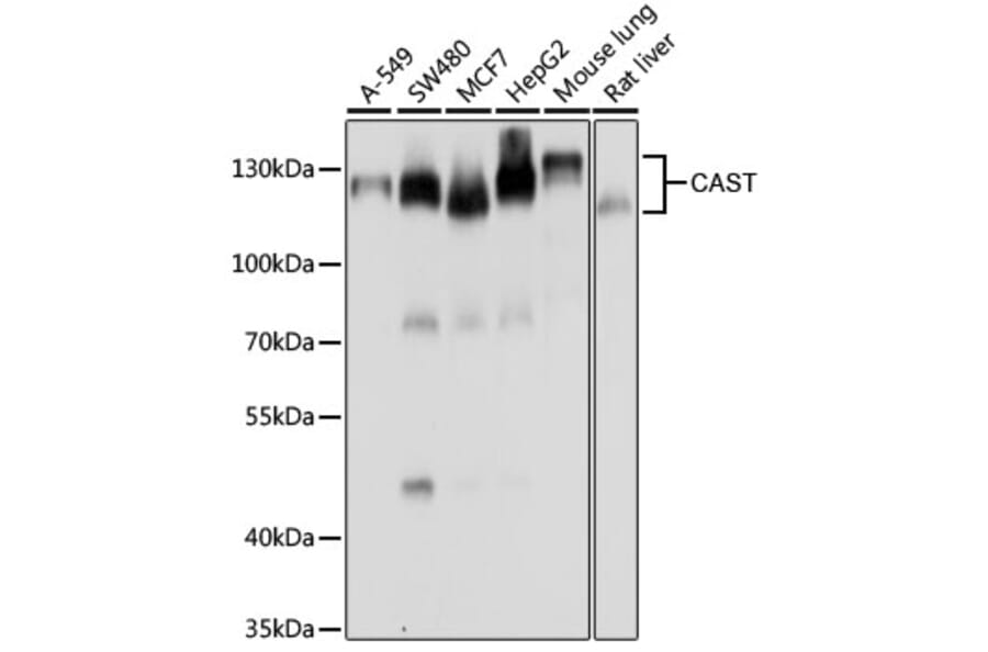 Western Blot - Anti-Calpastatin Antibody (A15816) - Antibodies.com