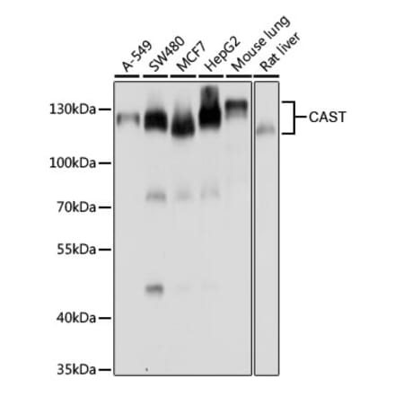 Western Blot - Anti-Calpastatin Antibody (A15816) - Antibodies.com