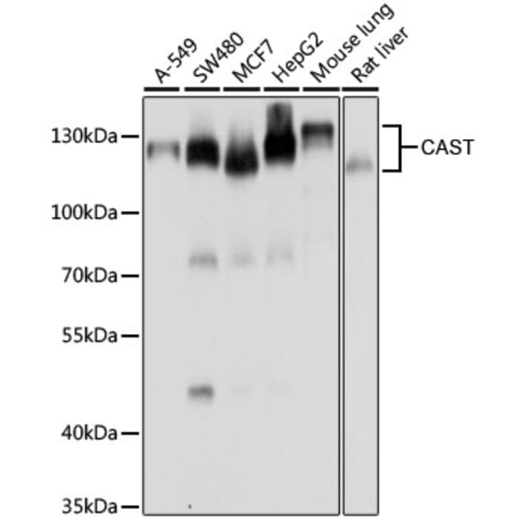 Western Blot - Anti-Calpastatin Antibody (A15816) - Antibodies.com