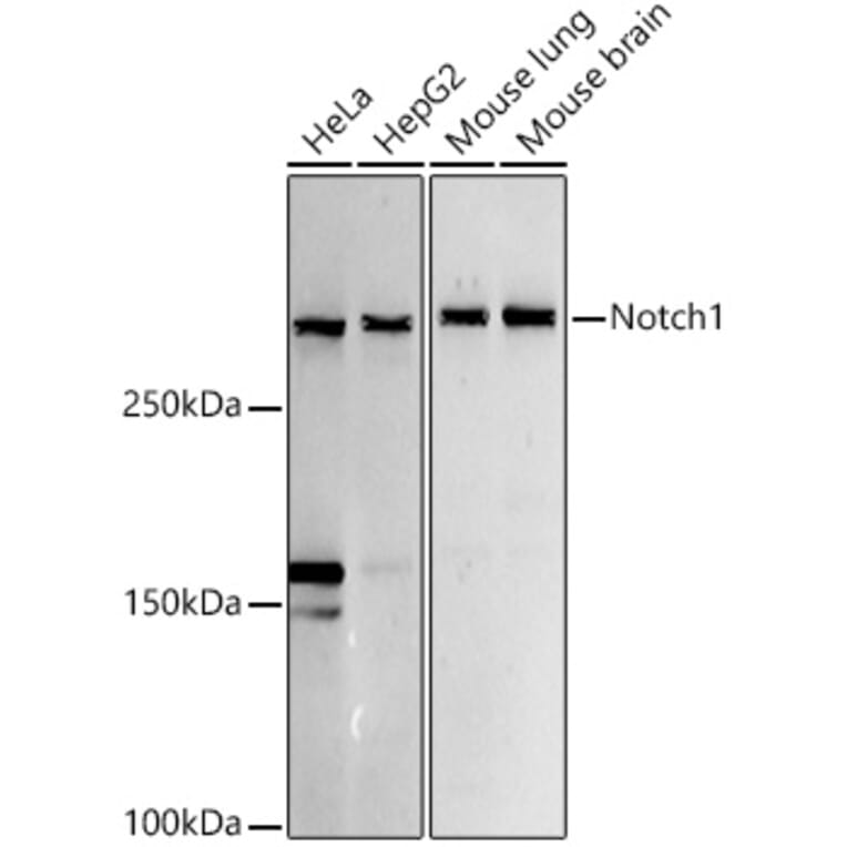 Western Blot - Anti-Notch1 Antibody (A15817) - Antibodies.com
