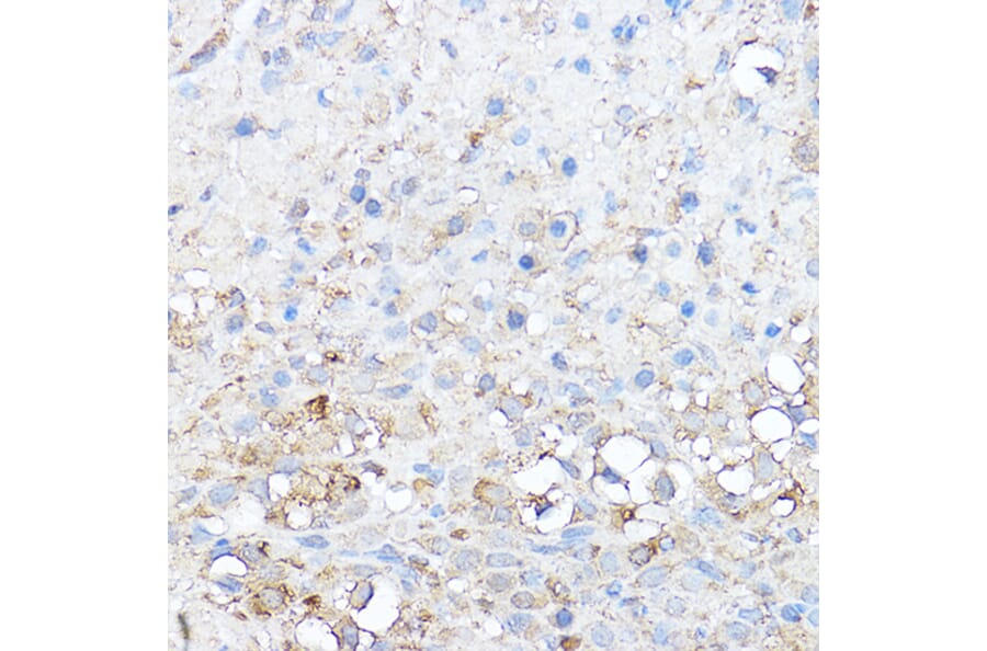 Immunohistochemistry - Anti-Notch1 Antibody (A15817) - Antibodies.com