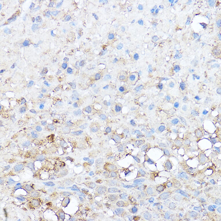 Immunohistochemistry - Anti-Notch1 Antibody (A15817) - Antibodies.com