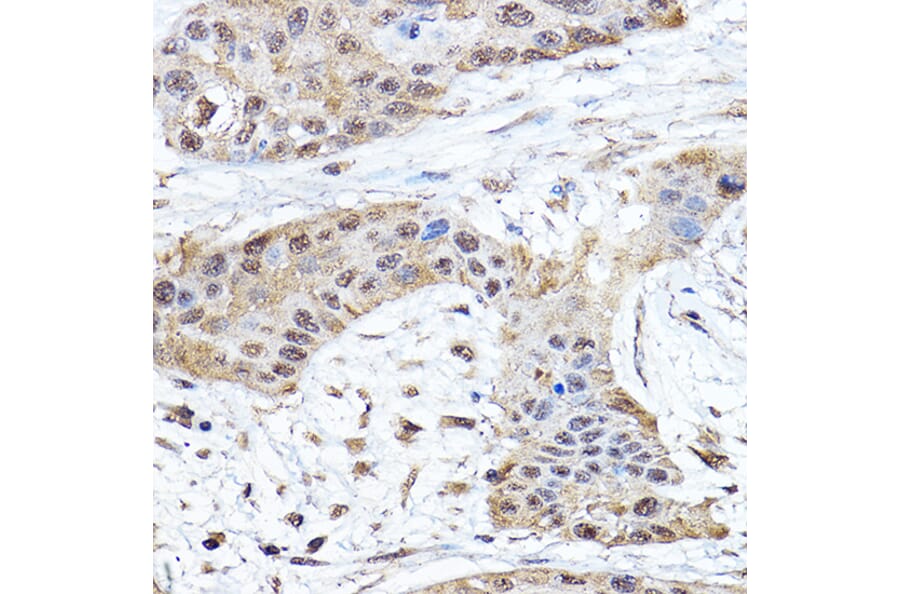 Immunohistochemistry - Anti-Notch1 Antibody (A15817) - Antibodies.com