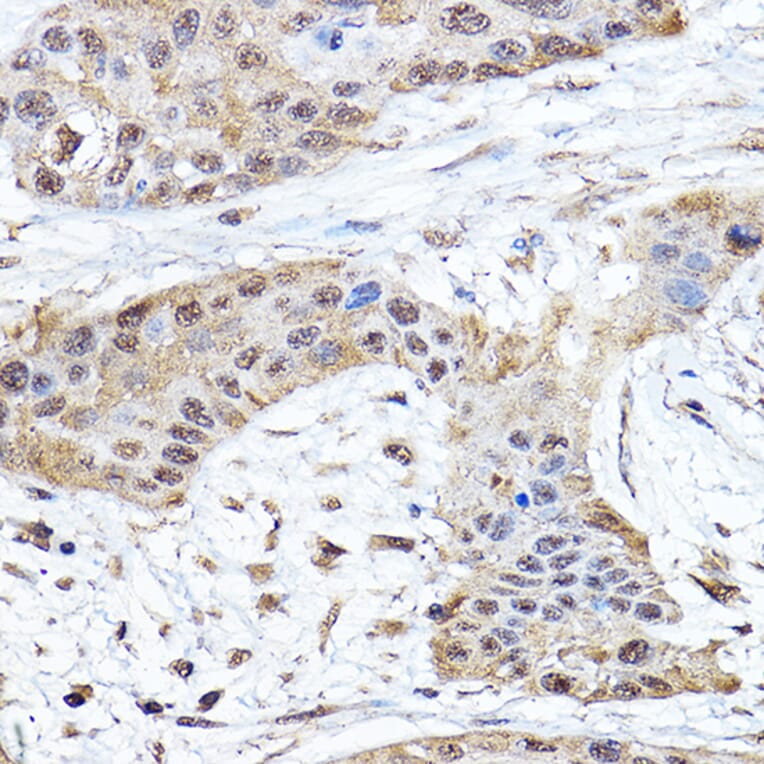 Immunohistochemistry - Anti-Notch1 Antibody (A15817) - Antibodies.com