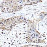 Immunohistochemistry - Anti-Notch1 Antibody (A15817) - Antibodies.com