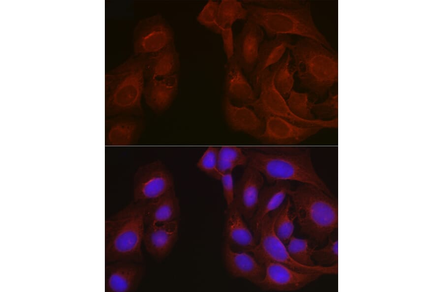 Immunofluorescence - Anti-Notch1 Antibody (A15817) - Antibodies.com