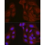 Immunofluorescence - Anti-Notch1 Antibody (A15817) - Antibodies.com
