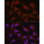 Immunofluorescence - Anti-Notch1 Antibody (A15817) - Antibodies.com