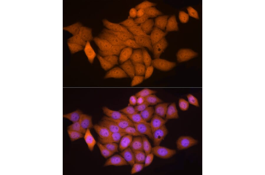Immunofluorescence - Anti-Notch1 Antibody (A15817) - Antibodies.com