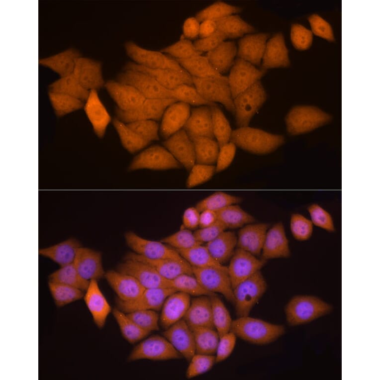 Immunofluorescence - Anti-Notch1 Antibody (A15817) - Antibodies.com