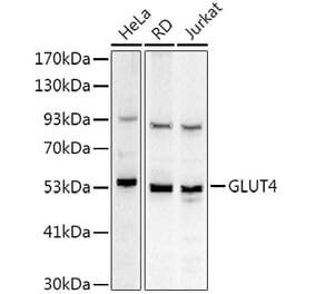 Western Blot - Anti-Glucose Transporter GLUT4 Antibody (A15818) - Antibodies.com