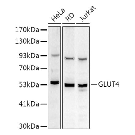 Western Blot - Anti-Glucose Transporter GLUT4 Antibody (A15818) - Antibodies.com
