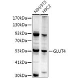 Western Blot - Anti-Glucose Transporter GLUT4 Antibody (A15818) - Antibodies.com