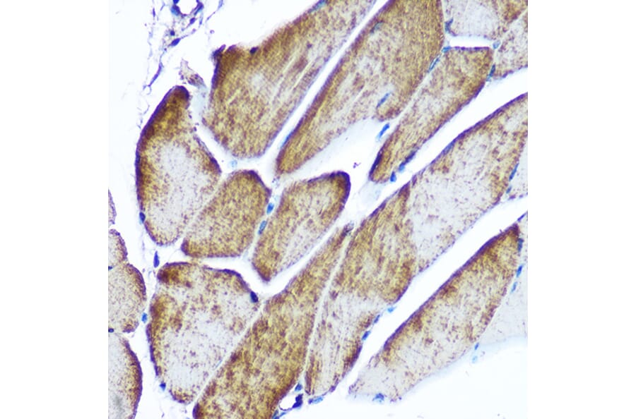 Immunohistochemistry - Anti-Glucose Transporter GLUT4 Antibody (A15818) - Antibodies.com