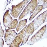 Immunohistochemistry - Anti-Glucose Transporter GLUT4 Antibody (A15818) - Antibodies.com