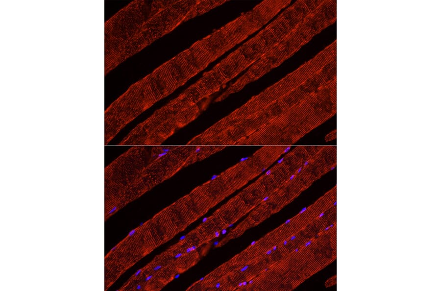 Immunofluorescence - Anti-Glucose Transporter GLUT4 Antibody (A15818) - Antibodies.com