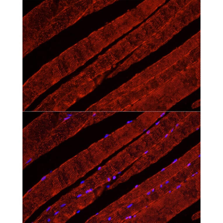 Immunofluorescence - Anti-Glucose Transporter GLUT4 Antibody (A15818) - Antibodies.com