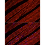 Immunofluorescence - Anti-Glucose Transporter GLUT4 Antibody (A15818) - Antibodies.com