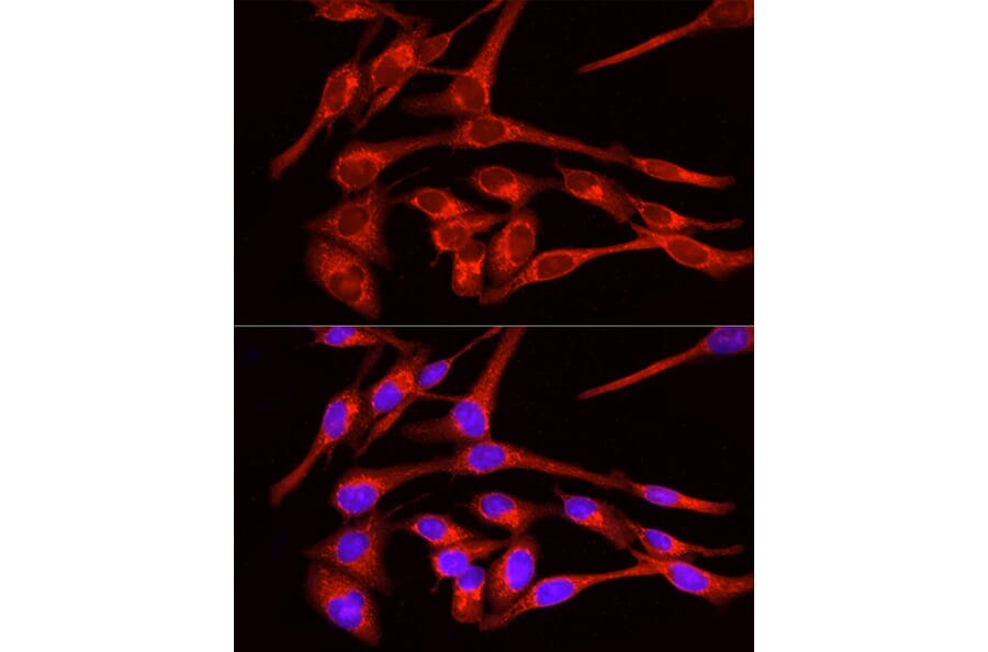 Immunofluorescence - Anti-Glucose Transporter GLUT4 Antibody (A15818) - Antibodies.com