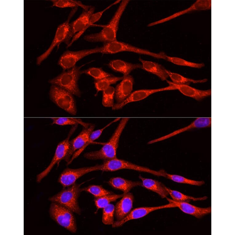 Immunofluorescence - Anti-Glucose Transporter GLUT4 Antibody (A15818) - Antibodies.com