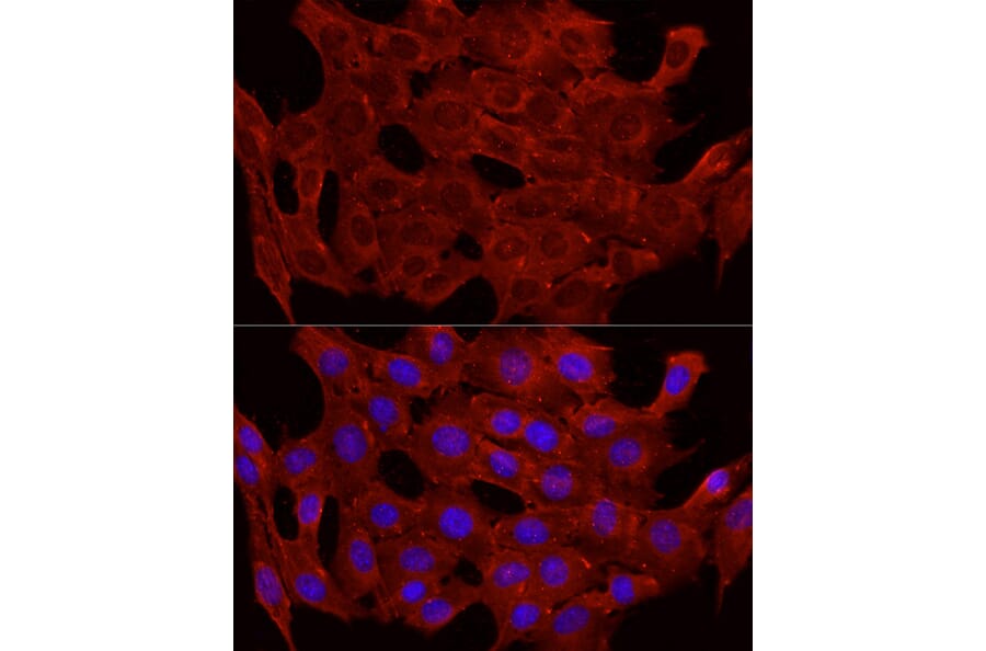 Immunofluorescence - Anti-Glucose Transporter GLUT4 Antibody (A15818) - Antibodies.com