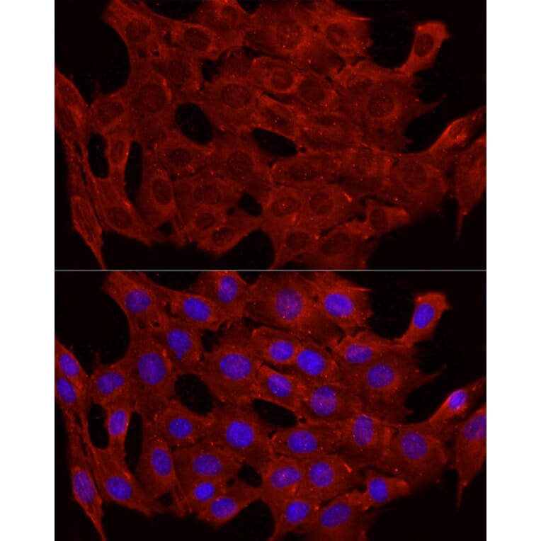 Immunofluorescence - Anti-Glucose Transporter GLUT4 Antibody (A15818) - Antibodies.com