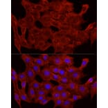 Immunofluorescence - Anti-Glucose Transporter GLUT4 Antibody (A15818) - Antibodies.com