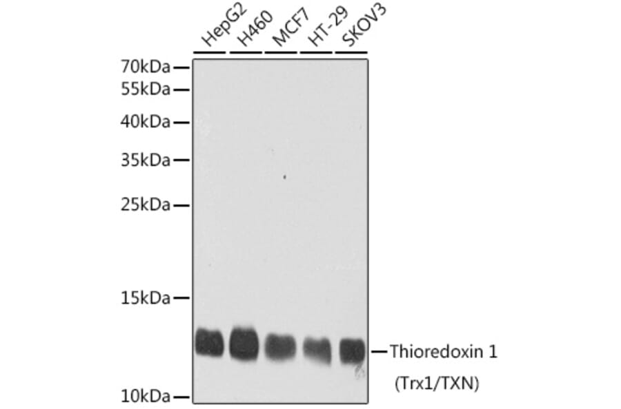 Western Blot - Anti-Thioredoxin/TRX Antibody (A15819) - Antibodies.com