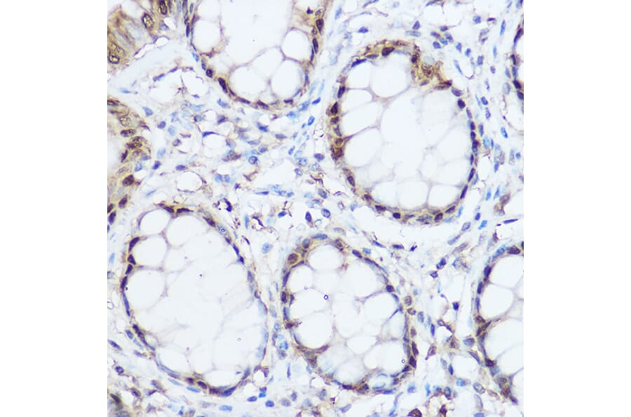 Immunohistochemistry - Anti-Thioredoxin/TRX Antibody (A15819) - Antibodies.com
