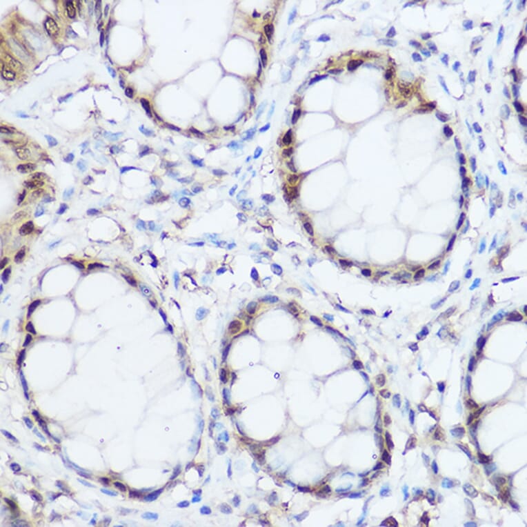 Immunohistochemistry - Anti-Thioredoxin/TRX Antibody (A15819) - Antibodies.com
