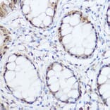 Immunohistochemistry - Anti-Thioredoxin/TRX Antibody (A15819) - Antibodies.com