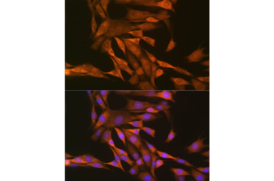 Immunofluorescence - Anti-Thioredoxin/TRX Antibody (A15819) - Antibodies.com